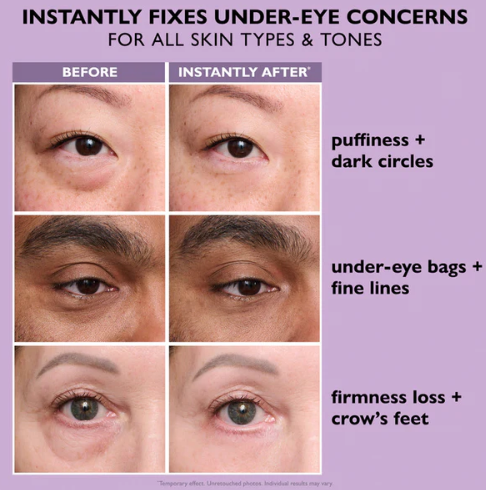 Revitalize Your Eyes and Rediscover Confidence